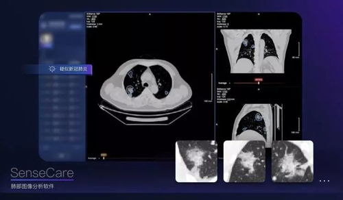 AI戰疫 人工智能在疫情防控中的軟件開發與應用
